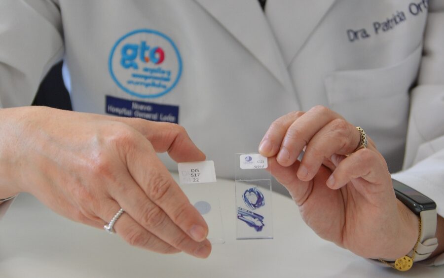 SSG aplica más de 177 mil tamizajes a mujeres guanajuatenses para detectar cancer cervicouterino