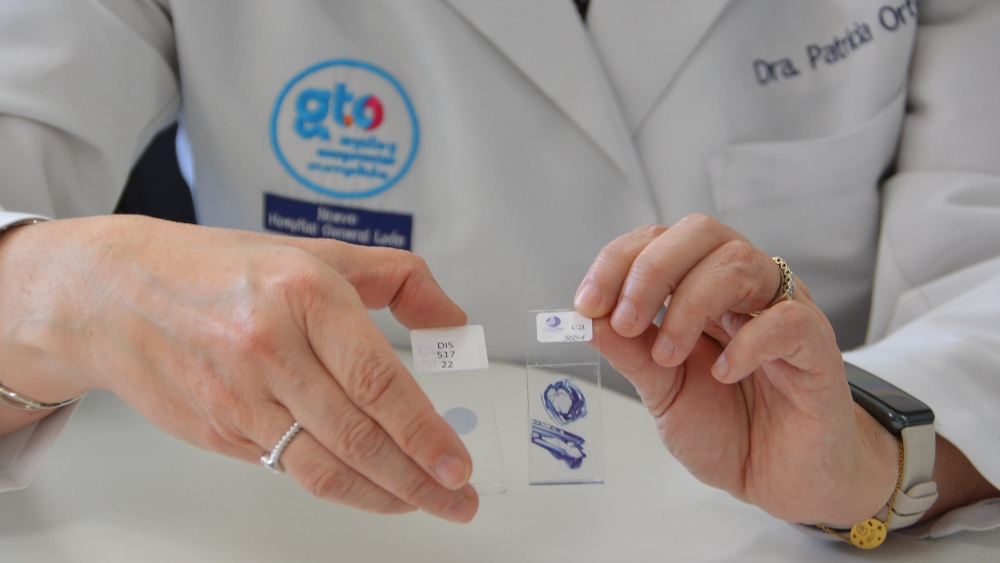 SSG aplica más de 177 mil tamizajes a mujeres guanajuatenses para detectar cancer cervicouterino